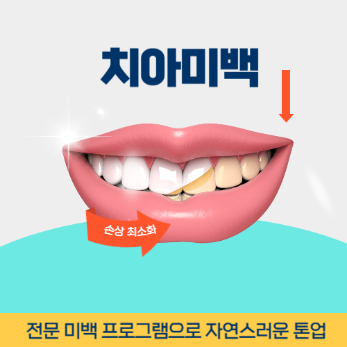 서산치과 서산시 치과 치아미백