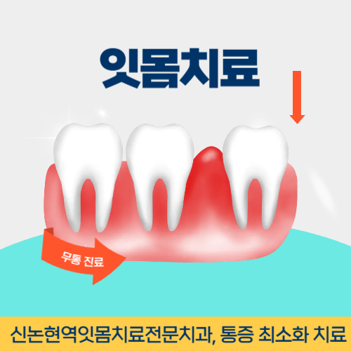 서산치과 서산시 치과 잇몸치료